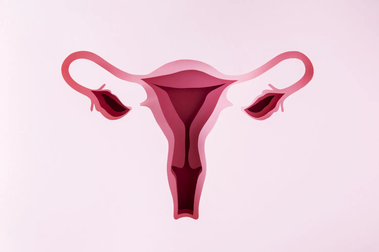 Myth & Facts about Endometriosis