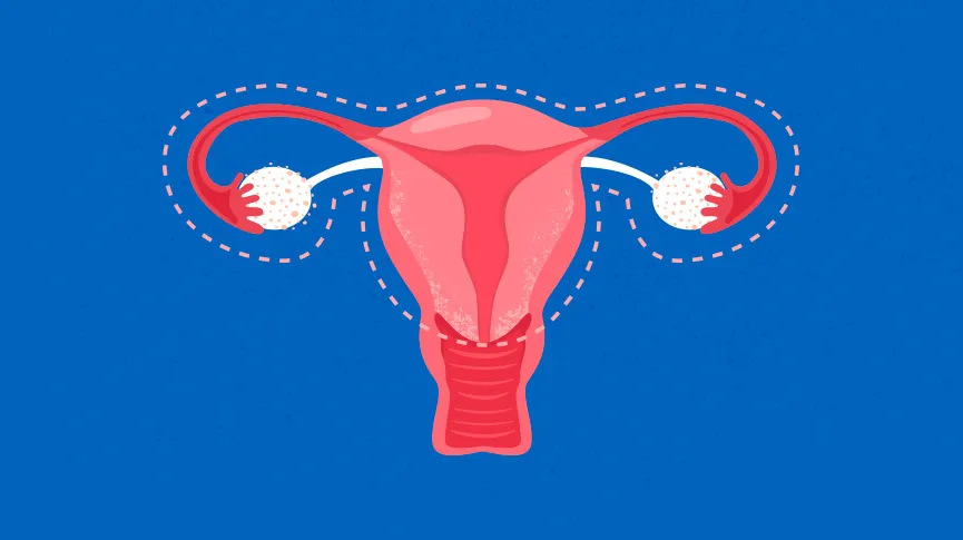 Things to know about Hysterectomy: Purpose and Procedure