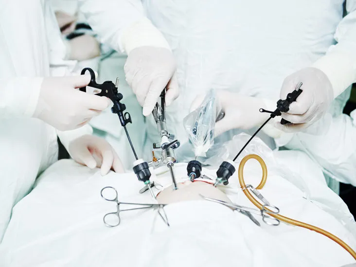 Best Gynaecologist Laparoscopic Surgeon in Delhi explains Laparoscopic Surgery - Blog Image