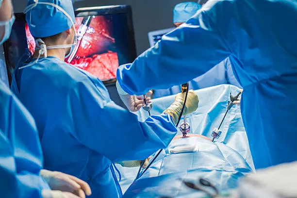 Exploring the Benefits of Laparoscopic Surgery in Gynecology: Minimally Invasive Solutions - Blog Image