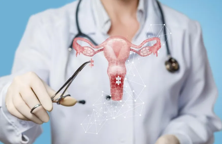 Exploring Hysterectomy for Fibroids: Understanding the Procedure and Treatment Options - Blog Image