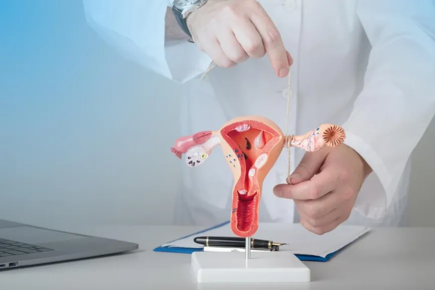 Understanding Uterus Removal for Fibroids - Blog Image
