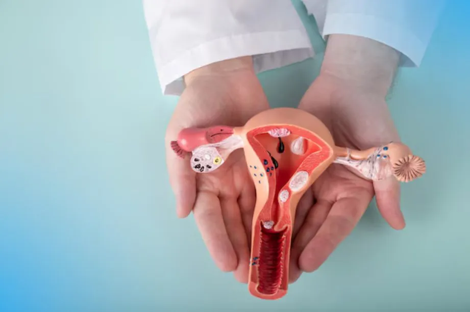 Can You Get Pregnant with Endometriosis? Expert Insights and Tips - Blog Image