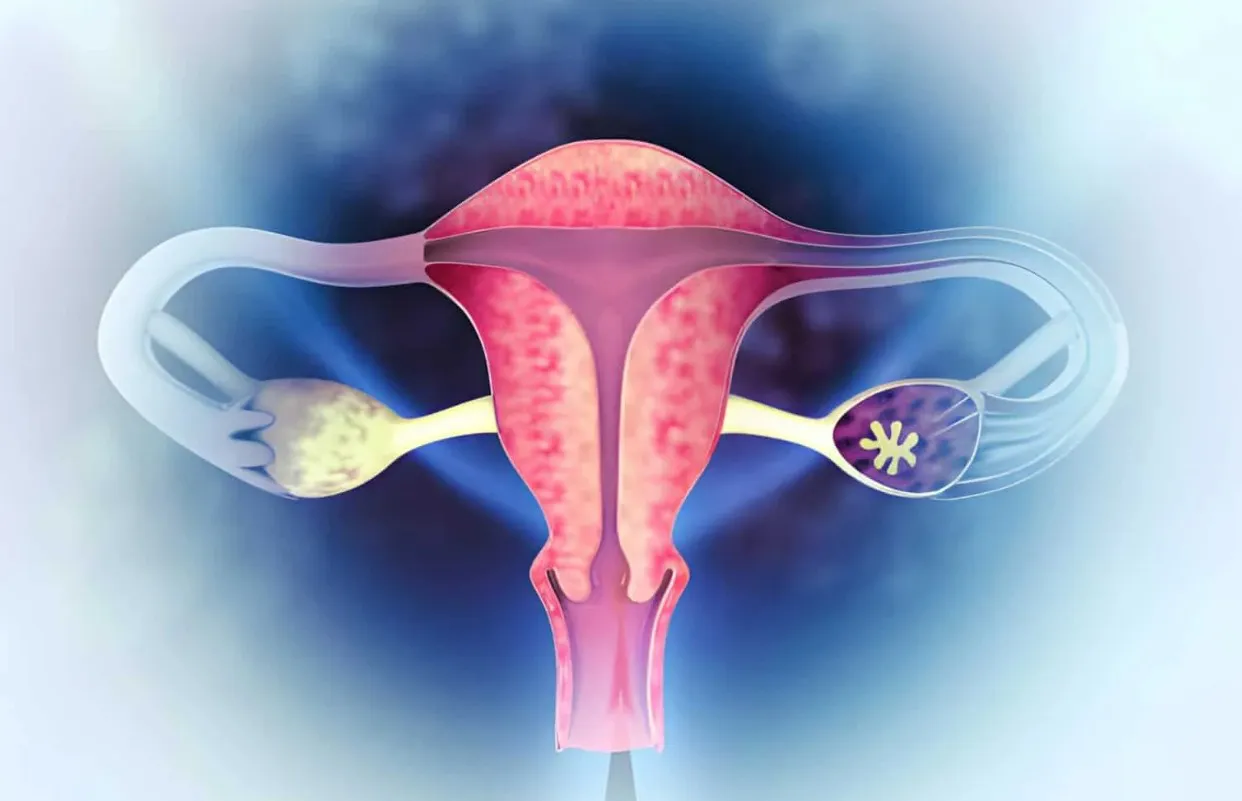 Endometriosis in Women: Early Signs, Symptoms, and When to See a Specialist in Delhi - Blog Image