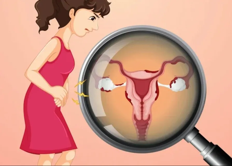 How Robotic Surgery Helps in Treating Ovarian Cysts - Blog Image