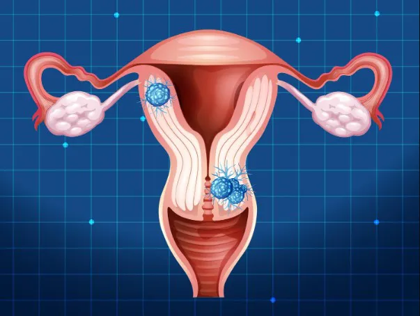 Comprehensive Guide to Women’s Annual Health Check-ups with a Gynecologist in Delhi - Blog Image