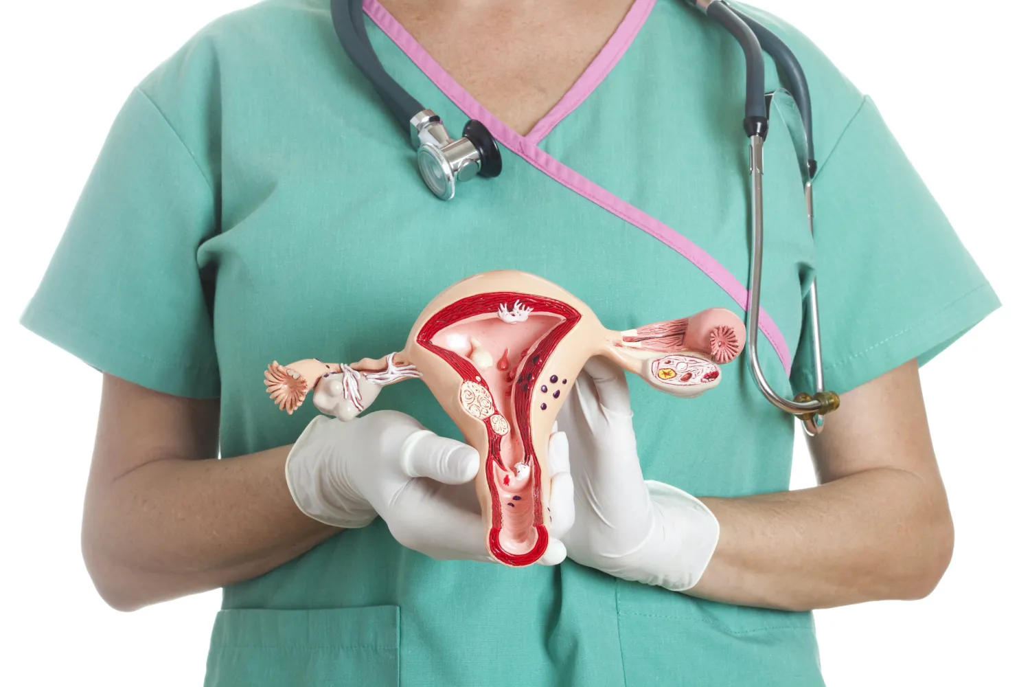 Cervical Cancer