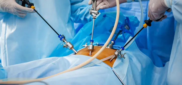 Laparoscopic Gynecological Surgery